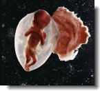 baby in womb photo
